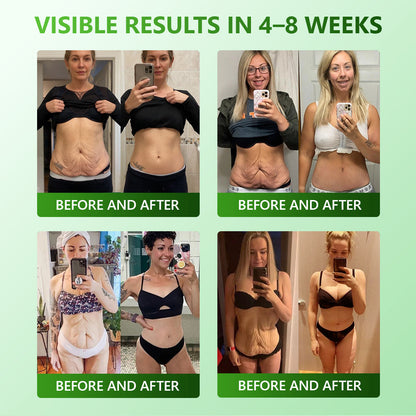 𝐋𝒐𝒕𝐦𝐚𝐲®𝐅𝐢𝐫𝐦𝐢𝐧𝐠 & 𝐀𝐧𝐭𝐢-𝐖𝐫𝐢𝐧𝐤𝐥𝐞 𝐒𝐭𝐞𝐦 𝐂𝐞𝐥𝐥 𝐂𝐨𝐥𝐥𝐚𝐠𝐞𝐧 𝐃𝐫𝐨𝐩𝐬 (𝐋𝐢𝐟𝐭 & 𝐅𝐢𝐫𝐦 𝐋𝐨𝐨𝐬𝐞 𝐒𝐤𝐢𝐧 𝐚𝐧𝐝 𝐑𝐞𝐝𝐮𝐜𝐞 𝐖𝐫𝐢𝐧𝐤𝐥𝐞 𝐅𝐨𝐫𝐦𝐚𝐭𝐢𝐨𝐧)- ⭐️