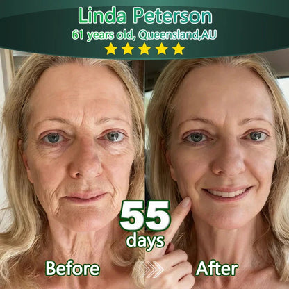 Bnodo® 🥇𝑆𝑡𝑒𝑚 𝐶𝑒𝑙𝑙 & 𝐶𝑜𝑙𝑙𝑎𝑔𝑒𝑛 𝑃𝑒𝑝𝑡𝑖𝑑𝑒 𝑂𝑟𝑎𝑙 𝐷𝑟𝑜𝑝𝑠 (Lift & Firm Sagging Skin & Reduce Wrinkle Formation)🎁+