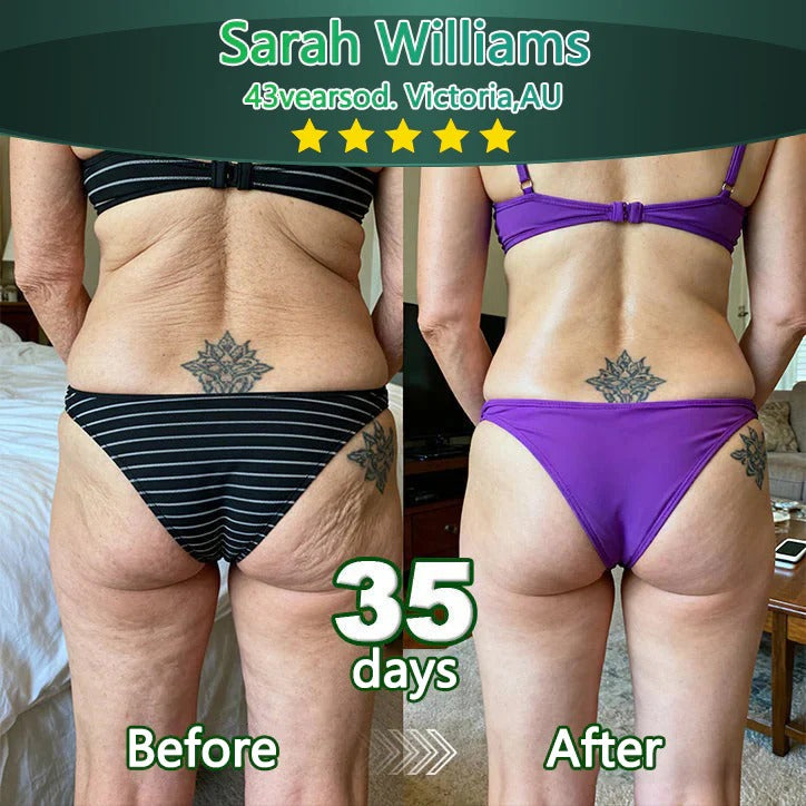 Bnodo® 🥇𝑆𝑡𝑒𝑚 𝐶𝑒𝑙𝑙 & 𝐶𝑜𝑙𝑙𝑎𝑔𝑒𝑛 𝑃𝑒𝑝𝑡𝑖𝑑𝑒 𝑂𝑟𝑎𝑙 𝐷𝑟𝑜𝑝𝑠 (Lift & Firm Sagging Skin & Reduce Wrinkle Formation)🎁+