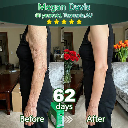 Bnodo® 🥇𝑆𝑡𝑒𝑚 𝐶𝑒𝑙𝑙 & 𝐶𝑜𝑙𝑙𝑎𝑔𝑒𝑛 𝑃𝑒𝑝𝑡𝑖𝑑𝑒 𝑂𝑟𝑎𝑙 𝐷𝑟𝑜𝑝𝑠 (Lift & Firm Sagging Skin & Reduce Wrinkle Formation)✅✅