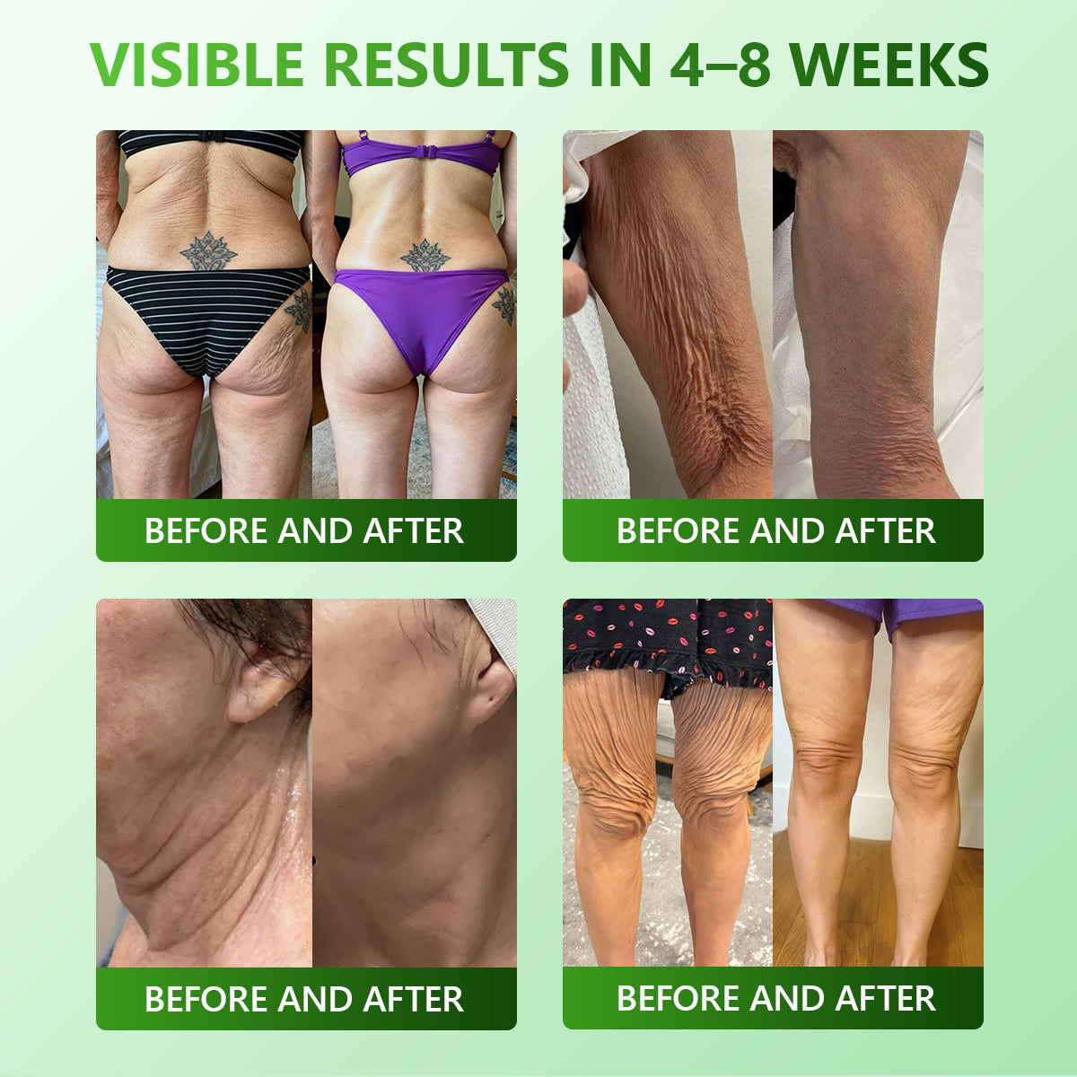 𝐋𝒐𝒕𝐦𝐚𝐲®𝐅𝐢𝐫𝐦𝐢𝐧𝐠 & 𝐀𝐧𝐭𝐢-𝐖𝐫𝐢𝐧𝐤𝐥𝐞 𝐒𝐭𝐞𝐦 𝐂𝐞𝐥𝐥 𝐂𝐨𝐥𝐥𝐚𝐠𝐞𝐧 𝐃𝐫𝐨𝐩𝐬 (𝐋𝐢𝐟𝐭 & 𝐅𝐢𝐫𝐦 𝐋𝐨𝐨𝐬𝐞 𝐒𝐤𝐢𝐧 𝐚𝐧𝐝 𝐑𝐞𝐝𝐮𝐜𝐞 𝐖𝐫𝐢𝐧𝐤𝐥𝐞 𝐅𝐨𝐫𝐦𝐚𝐭𝐢𝐨𝐧)- ⭐️